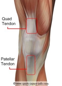 I have tendonitis in both these tendons